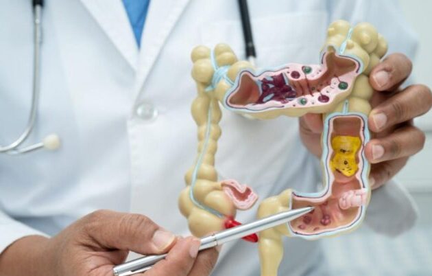 best piles treatment doctor in panchkula