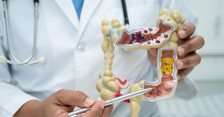 best piles treatment doctor in panchkula