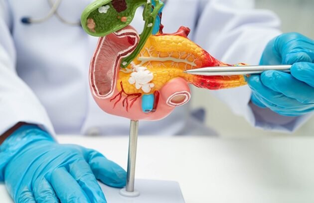 Gallbladder-Surgery-630x408