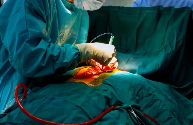 gallbladder surgery in zirakpur