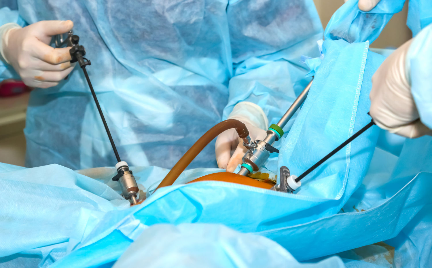 General Surgery - Curasia Hospital