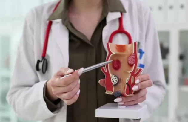 Best Piles Treatment Doctor in Panchkula